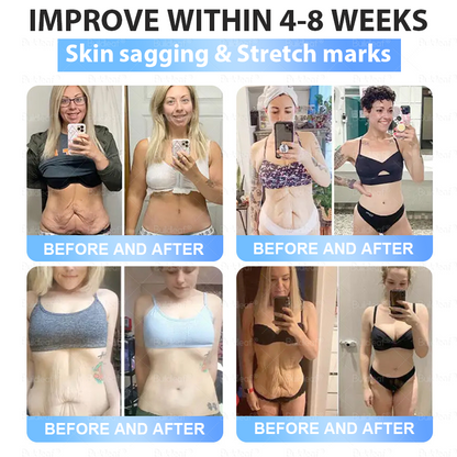 🇨🇦🇨🇦🇨🇦𝐇𝐞𝐚𝐥𝐭𝐡 𝐂𝐚𝐧𝐚𝐝𝐚 |𝐵uil𝗱𝐿ea𝐟® 𝑮𝐋𝑃-1 Slim & Firm 𝑁ano 𝑀icroneedle 𝑃atch with Collagen,Turmeric&Matrixyl 3000 丨Obesity,Cardiovascular Diseas, Diabetes, Sleep Apnea, Joint Problems and More