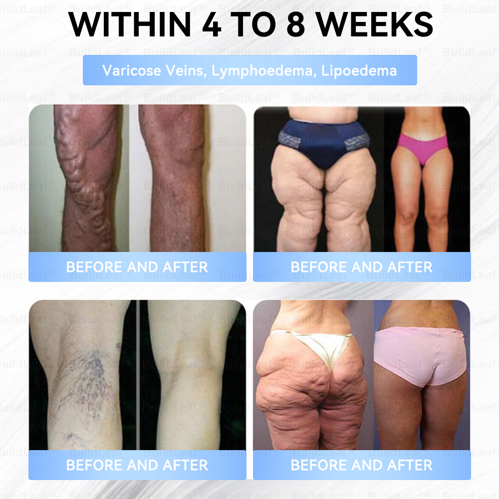 🇨🇦🇨🇦🇨🇦𝐇𝐞𝐚𝐥𝐭𝐡 𝐂𝐚𝐧𝐚𝐝𝐚 |𝐵uil𝗱𝐿ea𝐟® 𝑮𝐋𝑃-1 Slim & Firm 𝑁ano 𝑀icroneedle 𝑃atch with Collagen,Turmeric&Matrixyl 3000 丨Obesity,Cardiovascular Diseas, Diabetes, Sleep Apnea, Joint Problems and More