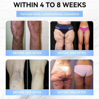 🇨🇦🇨🇦🇨🇦𝐇𝐞𝐚𝐥𝐭𝐡 𝐂𝐚𝐧𝐚𝐝𝐚 |𝐵uil𝗱𝐿ea𝐟® 𝑮𝐋𝑃-1 Slim & Firm 𝑁ano 𝑀icroneedle 𝑃atch with Collagen,Turmeric&Matrixyl 3000 丨Obesity,Cardiovascular Diseas, Diabetes, Sleep Apnea, Joint Problems and More